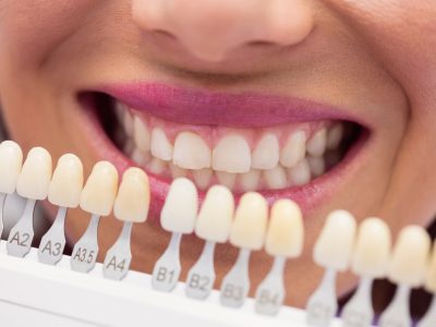 Dentist examining female patient with teeth shades at dental clinic