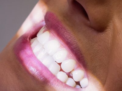 Close-up of female patient receiving a dental treatment at clinic